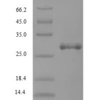 Ornithodoros moubata Tick anticoagulant peptide Recombinant Protein - BioCrest Sci