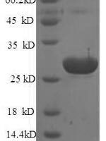Mouse Translationally-controlled tumor protein (Tpt1) Recombinant Protein - BioCrest Sci