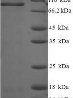 Rat Caprin-1 (Caprin1) Recombinant Protein - BioCrest Sci