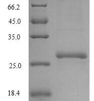 Mouse UMP-CMP kinase (Cmpk1) Recombinant Protein - BioCrest Sci
