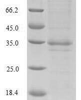 Bordetella pertussis Serotype 3 fimbrial subunit (fim3) Recombinant Protein, N-His-SUMO - BioCrest Sci
