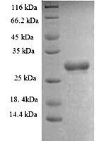 Human SWI/SNF complex subunit SMARCC1 (SMARCC1), partial Recombinant Protein, N-His - BioCrest Sci