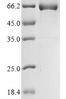 Tobacco mosaic virus Replicase large subunit, partial Recombinant Protein, N-His-Trx - BioCrest Sci