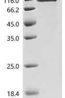 Frog virus 3 Major capsid protein (FV3-090R) Recombinant Protein - BioCrest Sci