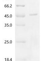 Mycobacterium tuberculosis PPE family immunomodulator PPE68 (PPE68) Recombinant Protein - BioCrest Sci