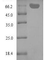Aeromonas salmonicida ADP-ribosyltransferase toxin AexT (aexT) Recombinant Protein - BioCrest Sci