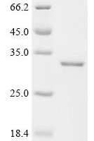 Human Ferritin heavy chain (FTH1) (C103A) Recombinant Protein - BioCrest Sci