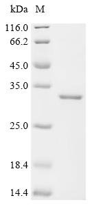 Human Ferritin heavy chain (FTH1) (C103A) Recombinant Protein, Homo sapiens (Human), E.coli, C-terminal 6xHis-tagged, 28.1 kDa, purity >≥ 95% as determined by SDS-PAGE.