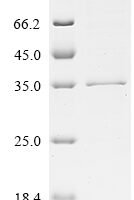 Human Fibroblast growth factor 14 (FGF14) Recombinant Protein, C-His - BioCrest Sci