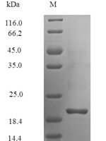 Androctonus australis Alpha-mammal toxin AaH2 Recombinant Protein - BioCrest Sci