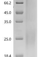 Mouse Interleukin-3 (Il3) Recombinant Protein, N-His - BioCrest Sci