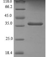 Human Thioredoxin-like protein 1 (TXNL1) Recombinant Protein, N-His - BioCrest Sci