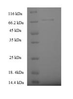 Human Serine palmitoyltransferase 2 (SPTLC2), partial Recombinant Protein, Homo sapiens (Human), E.coli, N-terminal 6xHis-SUMO-tagged, 69.7 kDa, purity >≥ 90% as determined by SDS-PAGE.