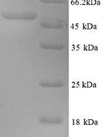 Human papillomavirus type 18 Minor capsid protein L2 (L2) Recombinant Protein, N-His - BioCrest Sci