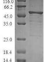 Human Serine/threonine-protein kinase 16 (STK16) Recombinant Protein - BioCrest Sci