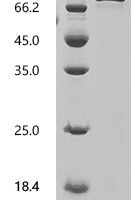 Pig Transferrin receptor protein 1 (TFRC), partial Recombinant Protein, N-10His - BioCrest Sci