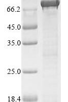 Escherichia coli Constitutive lysine decarboxylase (ldcC) Recombinant Protein - BioCrest Sci