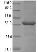 Macaca fascicularis Chymase (CMA1) Recombinant Protein - BioCrest Sci