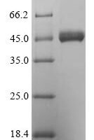 Mouse Thioredoxin-interacting protein (Txnip) Recombinant Protein, N-His - BioCrest Sci