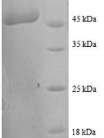 Human Transgelin (TAGLN) Recombinant Protein - BioCrest Sci