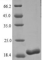 Rat Gremlin-1 (Grem1) Recombinant Protein, C-His - BioCrest Sci