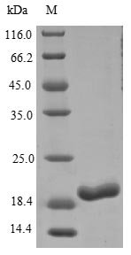 Rat Gremlin-1 (Grem1) Recombinant Protein, C-His, Rattus norvegicus (Rat), E.coli, C-terminal 6xHis-tagged, 20.2 kDa, purity >≥ 85% as determined by SDS-PAGE.