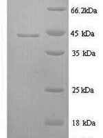 Sheep Interleukin-6 (IL6) Recombinant Protein - BioCrest Sci