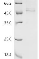 Mouse Caveolin-3 (Cav3) Recombinant Protein - BioCrest Sci