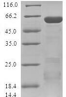 Human Zinc finger protein 346 (ZNF346) Recombinant Protein - BioCrest Sci
