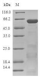 Human Zinc finger protein 346 (ZNF346) Recombinant Protein, Homo sapiens (Human), E.coli, N-terminal GST-tagged, 59.9 kDa, purity >≥ 90% as determined by SDS-PAGE.