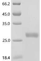 Mouse Interleukin-2 (Il2), Biotinylated Recombinant Protein - BioCrest Sci