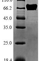 Arachis hypogaea Allergen Ara h 1, clone P17 Recombinant Protein - BioCrest Sci