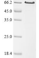 Human papillomavirus type 16 Minor capsid protein L2 (L2), partial Recombinant Protein - BioCrest Sci
