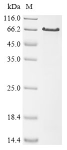 Human papillomavirus type 16 Minor capsid protein L2 (L2), partial Recombinant Protein, Human papillomavirus type 16, E.coli, N-terminal 10xHis-tagged, 49.7 kDa, purity >≥ 85% as determined by SDS-PAGE.