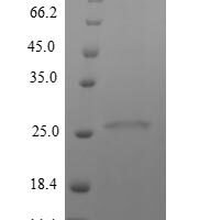 Mycobacterium tuberculosis Immunogenic protein MPT64 (mpt64) Recombinant Protein, N-His, aa 24–228, E.coli - BioCrest Sci