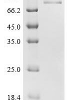 Mouse Growth arrest-specific protein 6 (Gas6) Recombinant Protein, C-10His, aa 28–674, Mammalian cell - BioCrest Sci