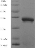 Drosophila melanogaster Ubiquitin-conjugating enzyme E2-17 kDa (UbcD6) Recombinant Protein, N-His-SUMO - BioCrest Sci