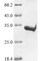 Human Piezo-type mechanosensitive ion channel component 1 (PIEZO1), partial Recombinant Protein - BioCrest Sci