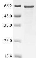 Mouse Neurofilament light polypeptide (Nefl) Recombinant Protein, Tag-Free - BioCrest Sci