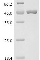 Xanthomonas albilineans cyclic-guanylate-specific phosphodiesterase, partial Recombinant Protein - BioCrest Sci