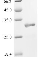 Mouse Tolloid-like protein 2 (Tll2), partial Recombinant Protein, C-His, aa 146–346, E.coli - BioCrest Sci