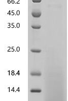 Chlamydia trachomatis serovar L2 Histone H1-like protein HC2 (hctB) Recombinant Protein - BioCrest Sci