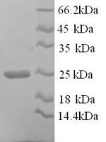 Rat Collagen alpha-1 (I) chain, partial Recombinant Protein - BioCrest Sci