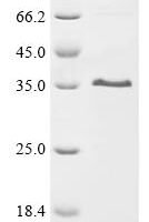Rat Matrix-remodeling-associated protein 7 (MXRA7), partial Recombinant Protein - BioCrest Sci