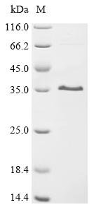 Rat Matrix-remodeling-associated protein 7 (MXRA7), partial Recombinant Protein, Rattus norvegicus (Rat), E.coli, C-terminal 6xHis-tagged, 19.9 kDa, purity >≥ 90% as determined by SDS-PAGE.