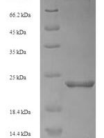 Danio rerio Metallothionein-1 (mt) Recombinant Protein - BioCrest Sci