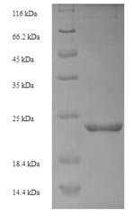 Danio rerio Metallothionein-1 (mt) Recombinant Protein, Danio rerio (Zebrafish) (Brachydanio rerio), E.coli, N-terminal 6xHis-SUMO-tagged, 22.0 kDa, purity >≥ 90% as determined by SDS-PAGE.