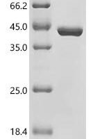 Arabidopsis thaliana Polyubiquitin 14 (UBQ14) Recombinant Protein - BioCrest Sci