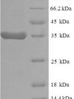 Human Eukaryotic translation elongation factor 1 epsilon-1 (EEF1E1) Recombinant Protein - BioCrest Sci