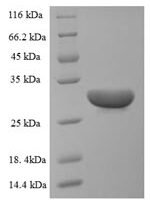 Momordica charantia Ribosome-inactivating protein momordin I Recombinant Protein - BioCrest Sci